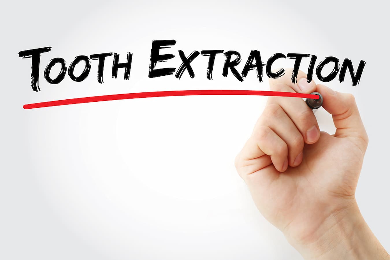 tooth extraction Albany NY